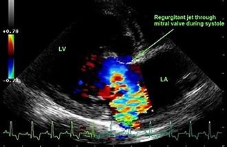 Diagnostic Ultrasound